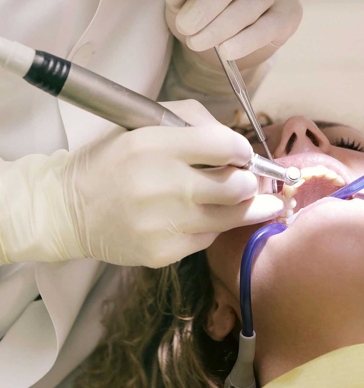 Tooth Decay Family Dental and Advanced Implant Center